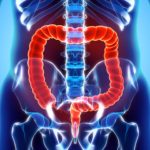 Nuove ricerche sui biomarcatori offrono nuova speranza contro il cancro colorettale