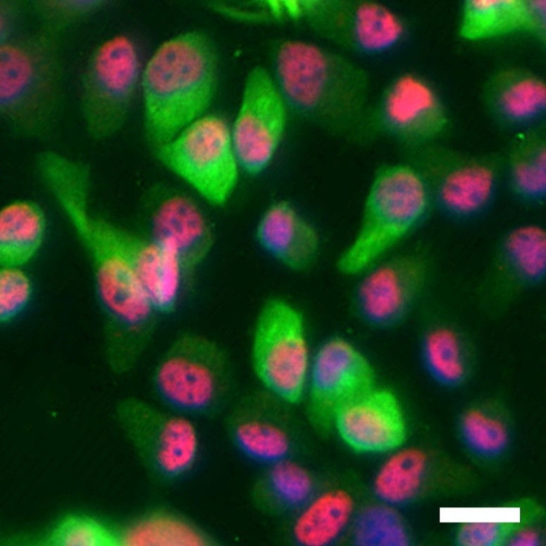 Tumore della pelle: scudo biologico contro le forme invasive