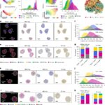 Mappatura del glioblastoma, scoperte 4 comunità cellulari tumorali ricorrenti, possibili obiettivi terapeutici