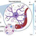 Un nuovo esame del sangue per la diagnosi precoce di Alzheimer
