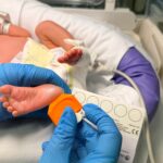 Diabete di tipo 1: il primo programma italiano di screening genetico neonatale per la prevenzione primaria